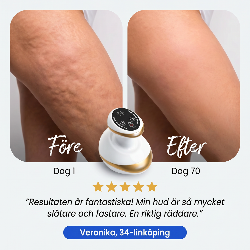 Zvarelo™— Cellulitapparaten som ger slätare och fastare hud utan klinikbesök