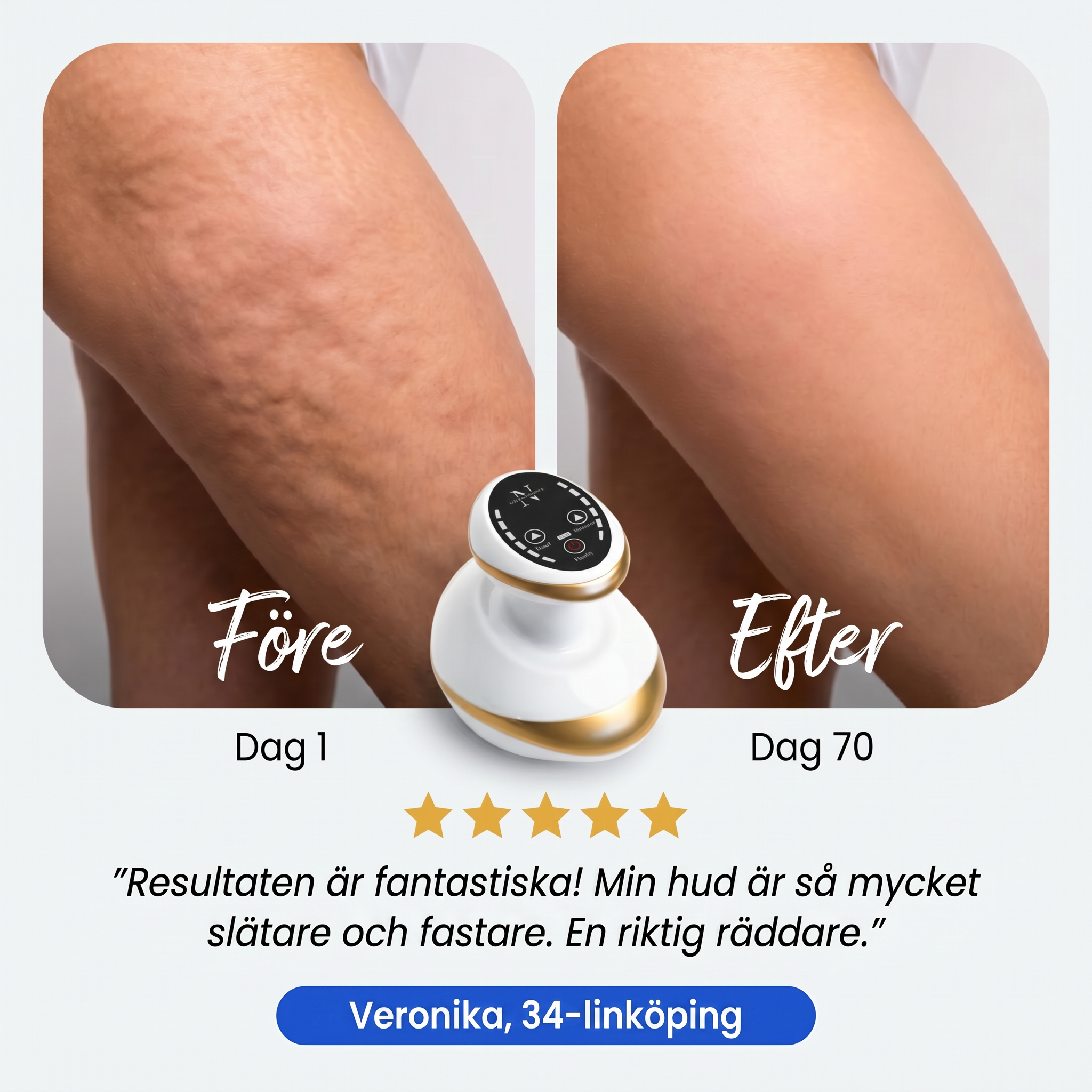 Zvarelo™— Cellulitapparaten som ger slätare och fastare hud utan klinikbesök